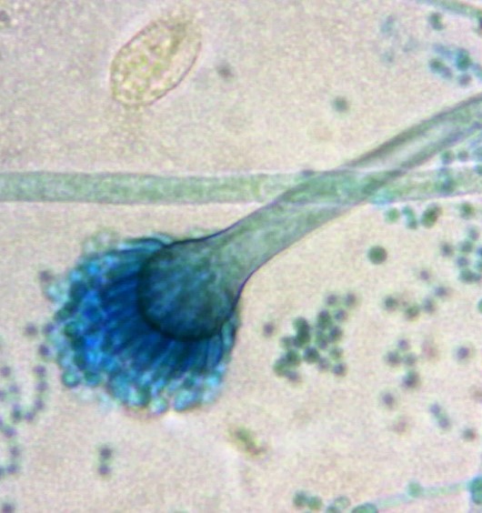 Aspergillus fumigatus 3